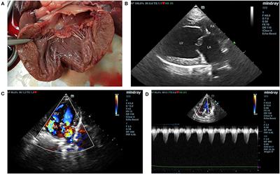 The Expression of Proteins Related to Serotonin Pathway in Pulmonary Arteries of Dogs Affected With Pulmonary Hypertension Secondary to Degenerative Mitral Valve Disease